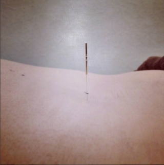 I